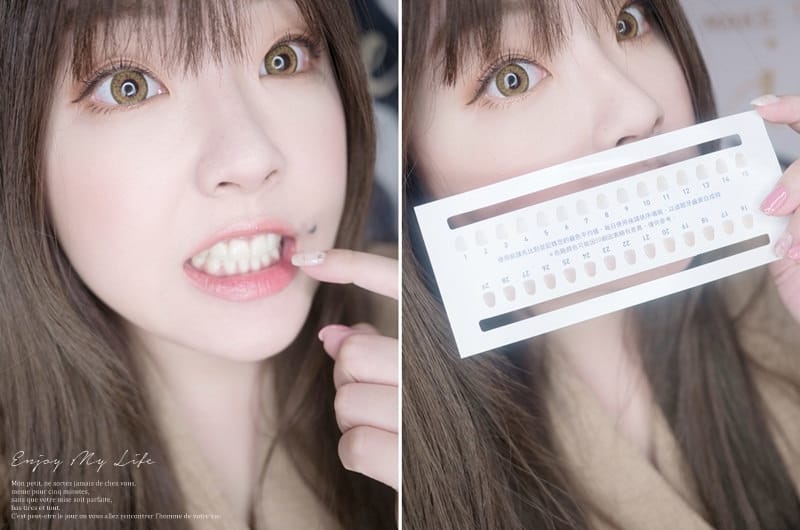 美齒 ♥ 幫牙齒也敷上美白面罩。Protis普麗斯 3D牙托式牙齒美白組 ♫ - 第10張圖 P1210030-tile